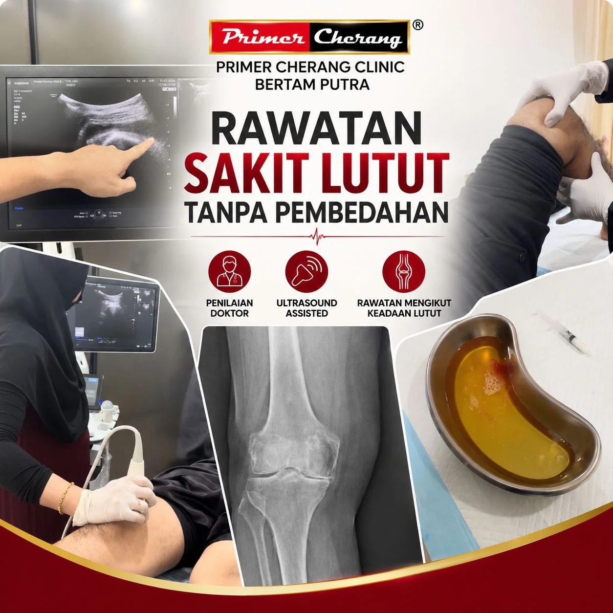 Rawatan sakit lutut tanpa pembedahan di Klinik Primer Cherang Bertam Putra: imbasan ultrasound lutut, x-ray osteoarthritis dan cecair lutut yang dikeluarkan